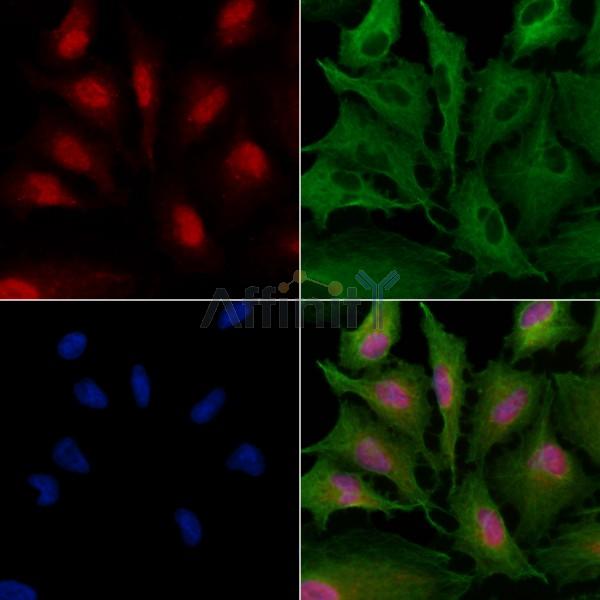 ZNF24 Antibody - DF3101 staining A549 cells by IF/ICC.