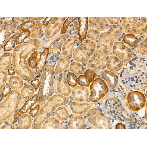 K6PL Antibody - DF3107 at 1/100 staining Rat kidney tissue by IHC-P.