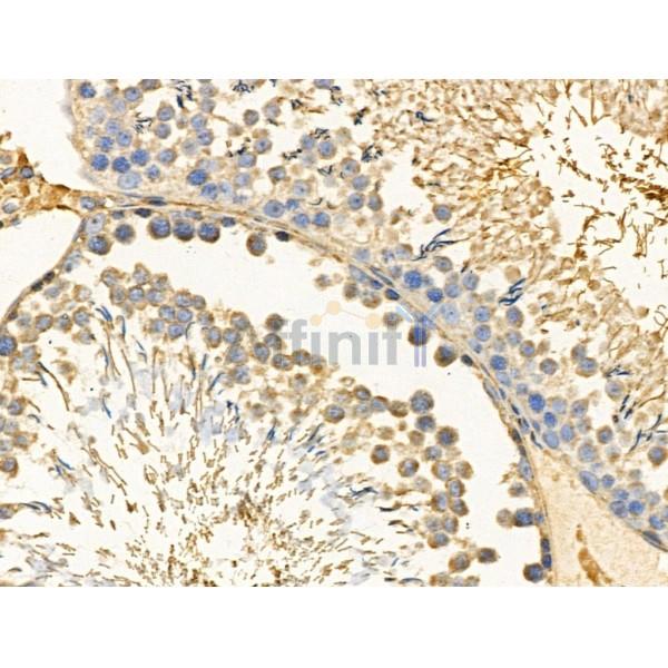 K6PL Antibody - DF3107 at 1/100 staining Rat testis tissue by IHC-P.