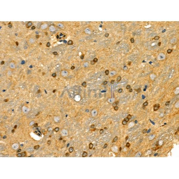 CSRP1 Antibody - DF3119 at 1/100 staining Rat brain tissue by IHC-P.