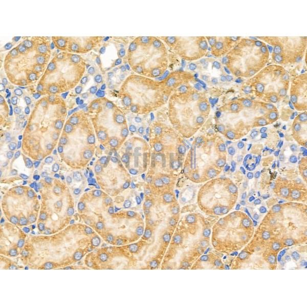 MARK3 Antibody - DF3135 at 1/100 staining Rat lung tissue by IHC-P.