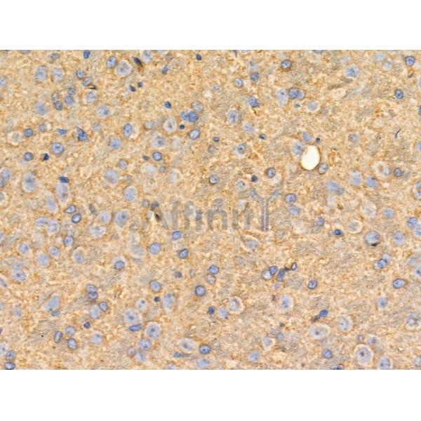 LTK Antibody - DF3146 at 1/100 staining Rat brain tissue by IHC-P.