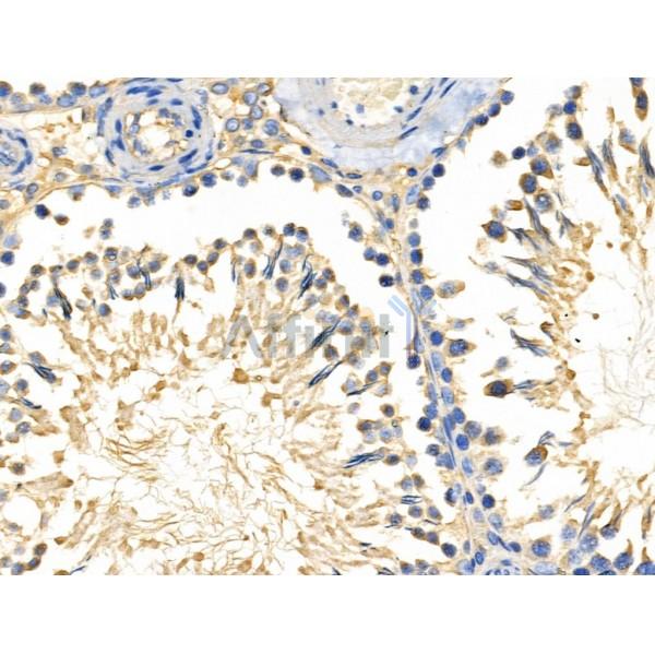 LTK Antibody - DF3146 at 1/100 staining Rat testis tissue by IHC-P.