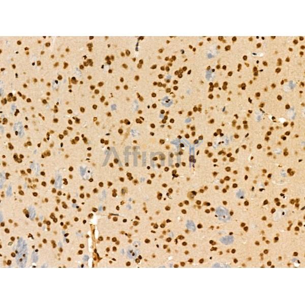CDK8 Antibody - DF3186 at 1/100 staining Mouse brain tissue by IHC-P.