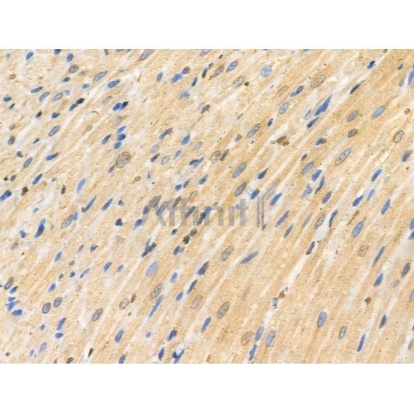 CDK8 Antibody - DF3186 at 1/100 staining Rat heart tissue by IHC-P.