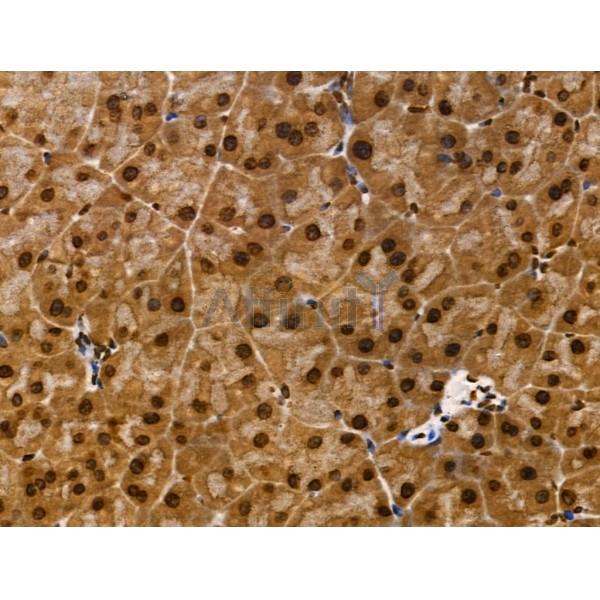 CDK8 Antibody - DF3186 at 1/100 staining Mouse pancreatic tissue by IHC-P.