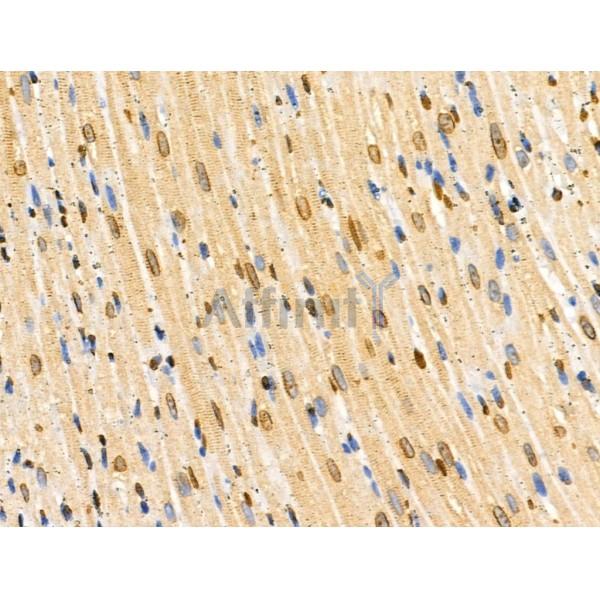 COPS2 Antibody - DF3222 at 1/100 staining Rat heart tissue by IHC-P.
