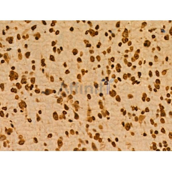 PITX1 Antibody - DF3224 at 1/100 staining Mouse brain tissue by IHC-P.