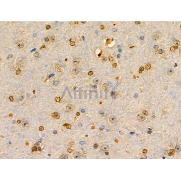 PITX1 Antibody - DF3224 at 1/100 staining Rat brain tissue by IHC-P.
