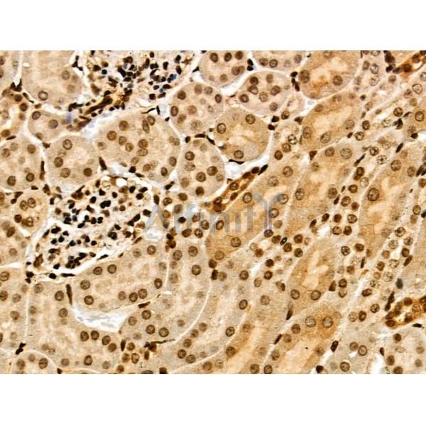 TRIP4 Antibody - DF3295 at 1/100 staining Mouse kidney tissue by IHC-P.