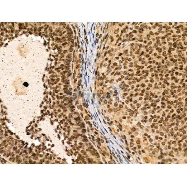 TRIP4 Antibody - DF3295 at 1/100 staining Rat ovarian tissue by IHC-P.