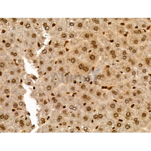 TRIP4 Antibody - DF3295 at 1/100 staining Mouse liver tissue by IHC-P.
