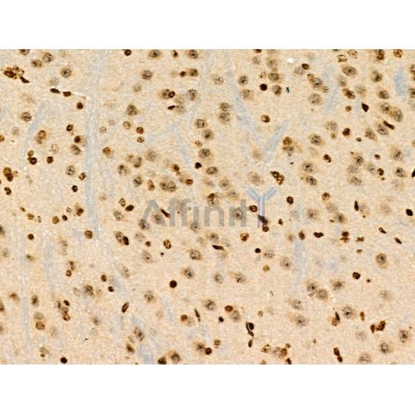 TRIP4 Antibody - DF3295 at 1/100 staining Mouse brain tissue by IHC-P.