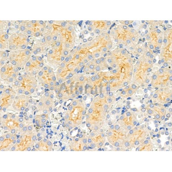 ADCK3 Antibody - DF3360 at 1/100 staining Rat kidney tissue by IHC-P.