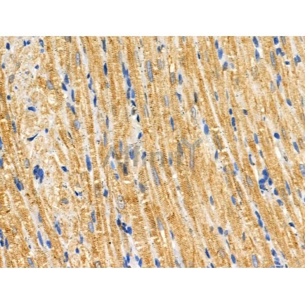 ADCK3 Antibody - DF3360 at 1/100 staining Rat heart tissue by IHC-P.