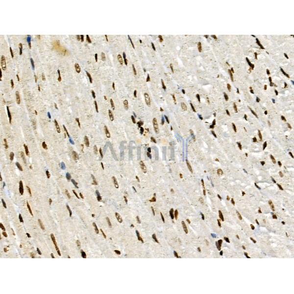 PPP1R14C Antibody - DF3361 at 1/100 staining Rat heart tissue by IHC-P.