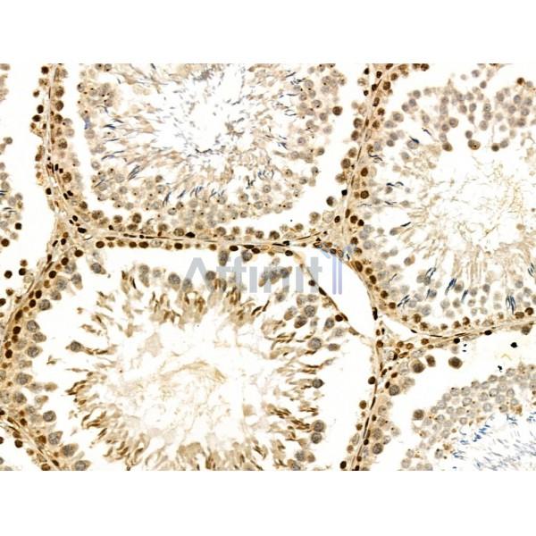PPP1R14C Antibody - DF3361 at 1/100 staining Rat testis tissue by IHC-P.