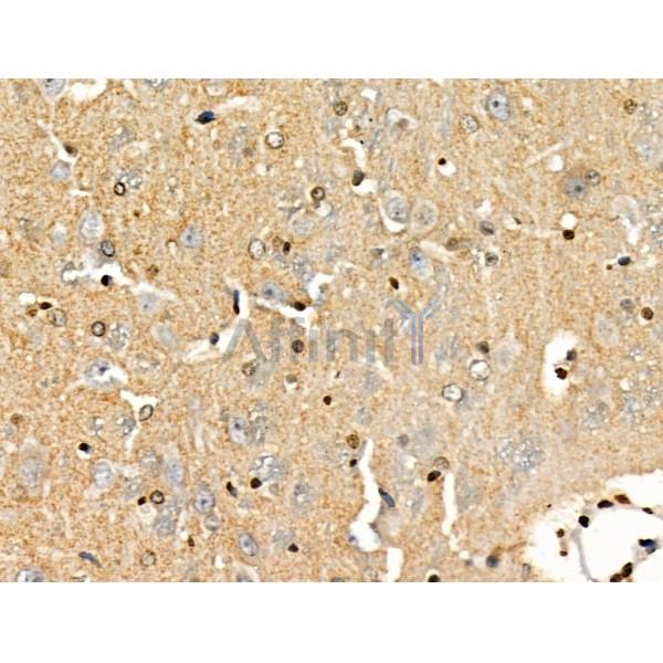 PPP1R14C Antibody - DF3361 at 1/100 staining Rat brain tissue by IHC-P.