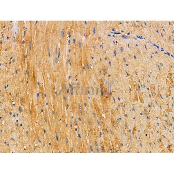 DOK4 Antibody - DF3369 at 1/100 staining Mouse heart tissue by IHC-P.
