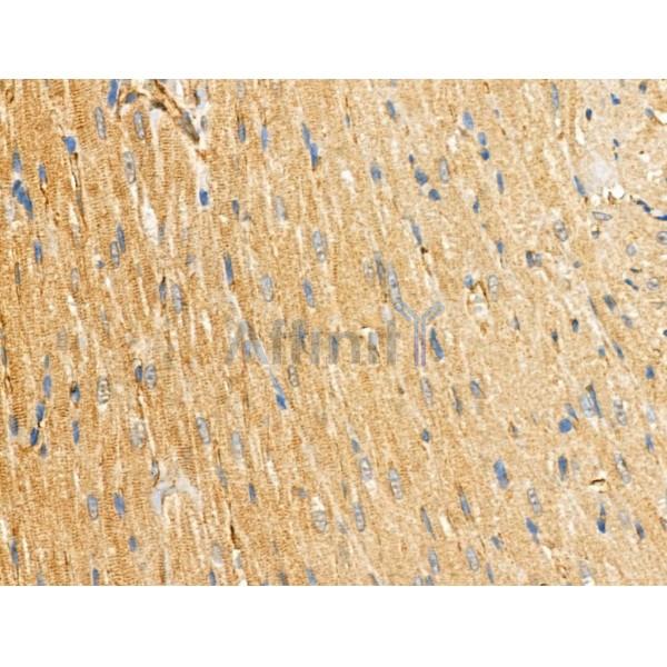 ABHD2 Antibody - DF3719 at 1/100 staining Rat heart tissue by IHC-P.