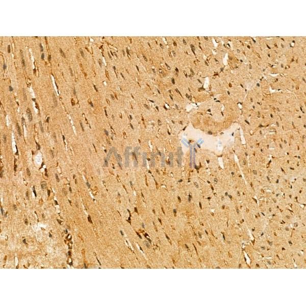 ABHD2 Antibody - DF3719 at 1/100 staining Mouse heart tissue by IHC-P.