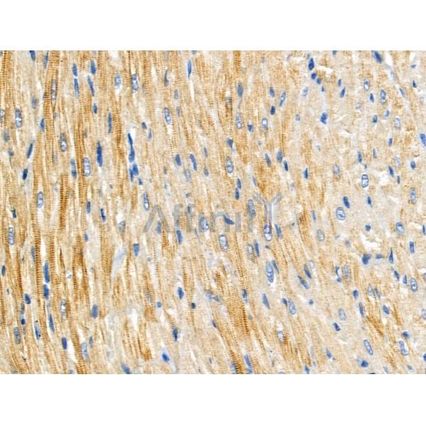 ARL2BP Antibody - DF3749 at 1/100 staining Rat heart tissue by IHC-P.