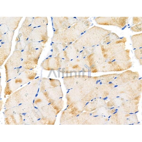 SGCA Antibody - DF3764 at 1/100 staining Rat muscle tissue by IHC-P.