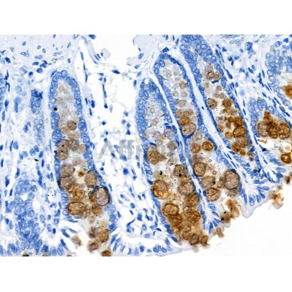 SGCA Antibody - DF3764 at 1/100 staining Rat colorectal tissue by IHC-P.