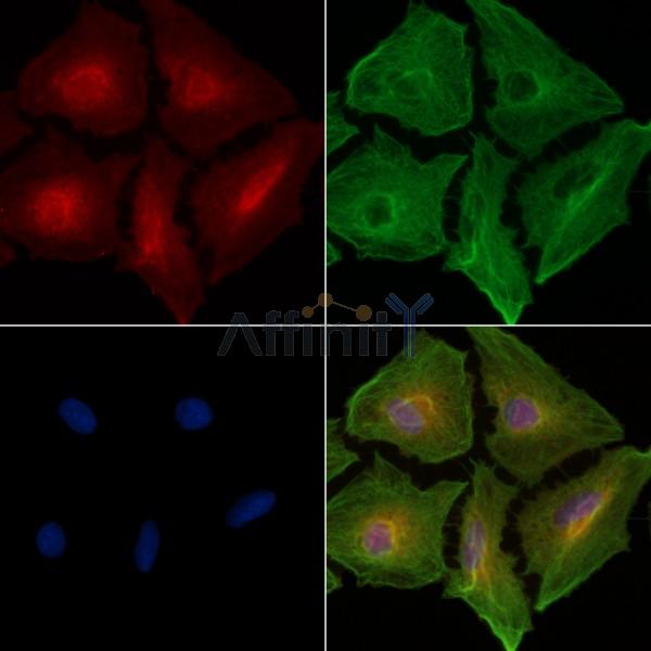 AMPH Antibody - DF3767 staining A549 cells by IF/ICC.