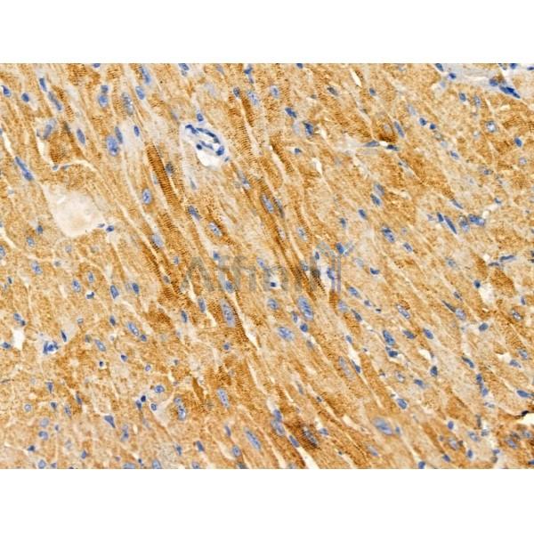 ARFIP1 Antibody - DF3790 at 1/100 staining Mouse heart tissue by IHC-P.