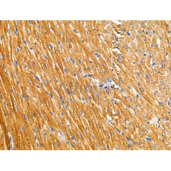 ARFIP1 Antibody - DF3790 at 1/100 staining Rat heart tissue by IHC-P.