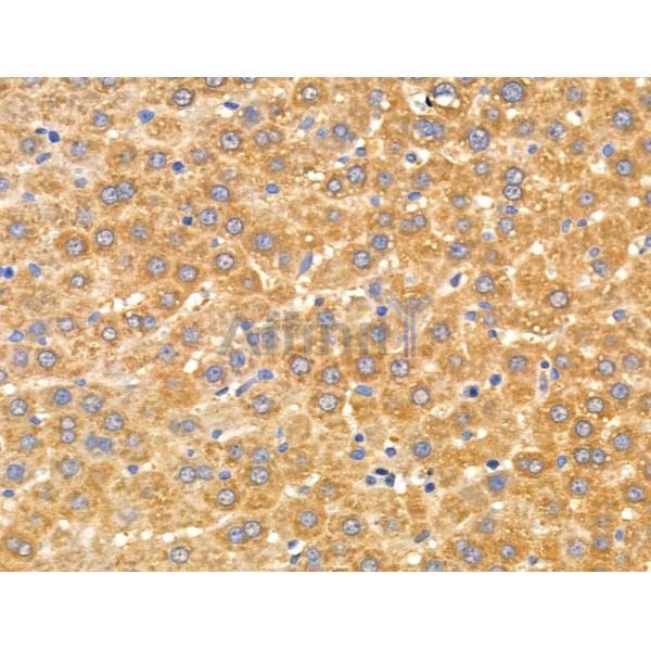 ARSA Antibody - DF3794 at 1/100 staining Rat liver tissue by IHC-P.
