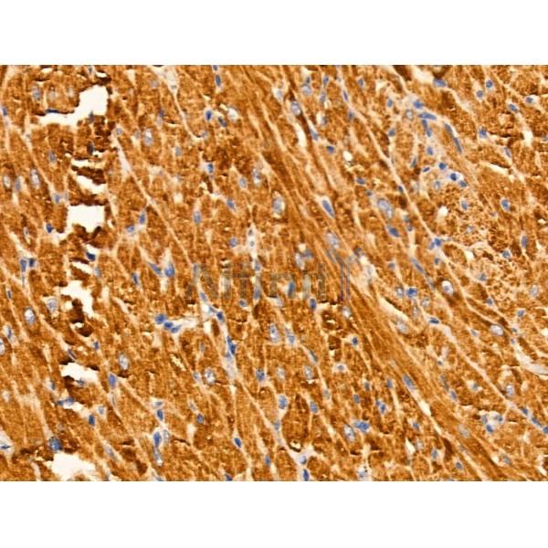 ARSA Antibody - DF3794 at 1/100 staining Rat heart tissue by IHC-P.