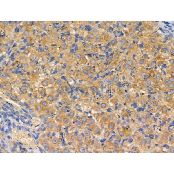 ABCF2 Antibody - DF3816 at 1/100 staining Rat ovarian tissue by IHC-P.