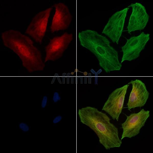 B3GALT1 Antibody - DF3833 staining A549 cells by IF/ICC.