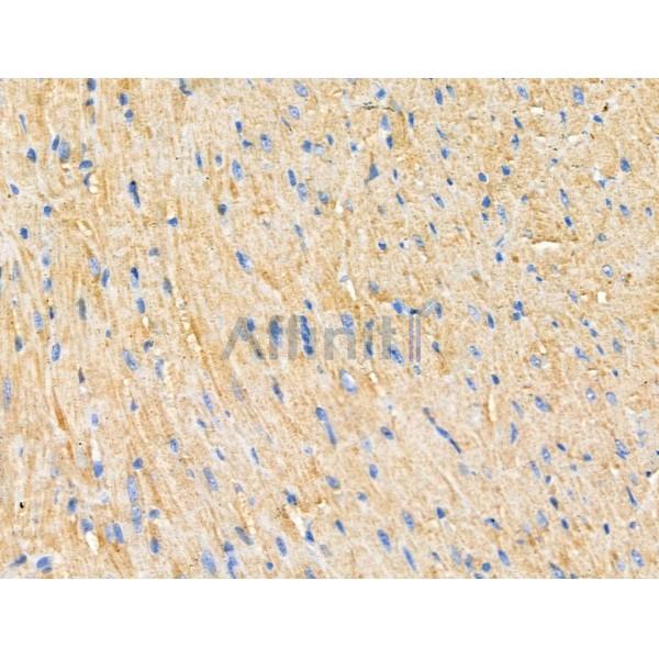 PNPLA8 Antibody - DF3865 at 1/100 staining Mouse heart tissue by IHC-P.