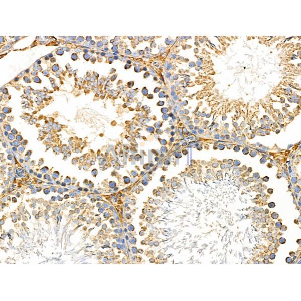 PNPLA8 Antibody - DF3865 at 1/100 staining Rat testis tissue by IHC-P.