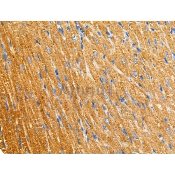 PNPLA8 Antibody - DF3865 at 1/100 staining Rat heart tissue by IHC-P.