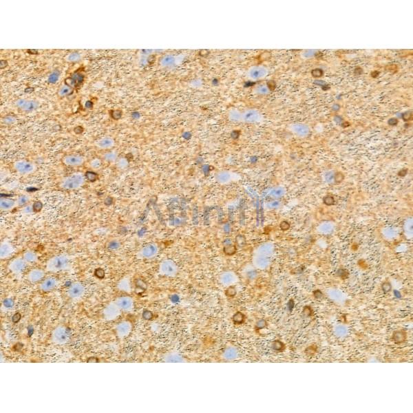 CAGE1 Antibody - DF3875 at 1/100 staining Mouse brain tissue by IHC-P.