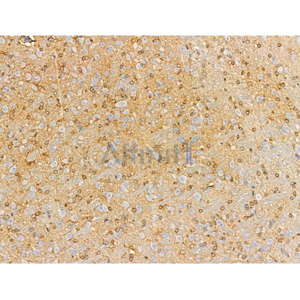 CAGE1 Antibody - DF3875 at 1/100 staining Rat brain tissue by IHC-P.