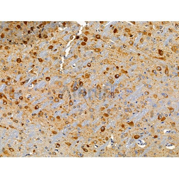 CLIP4 Antibody - DF3879 at 1/100 staining Rat brain tissue by IHC-P.