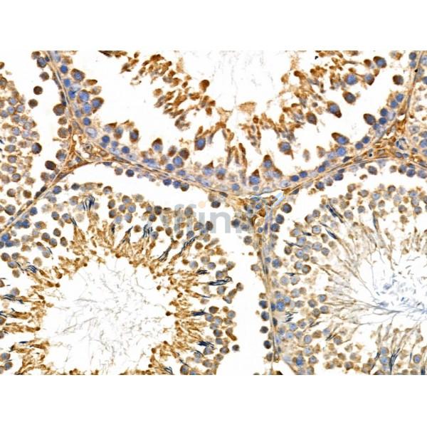 CHSY1 Antibody - DF3939 at 1/100 staining Rat testis tissue by IHC-P.