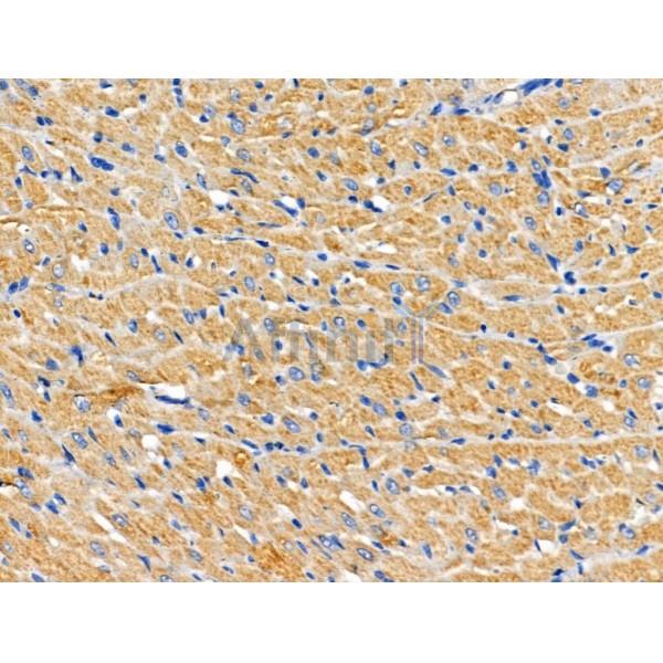 CHSY1 Antibody - DF3939 at 1/100 staining Rat heart tissue by IHC-P.