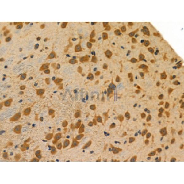 ENDOGL1 Antibody - DF4040 at 1/100 staining Mouse brain tissue by IHC-P.