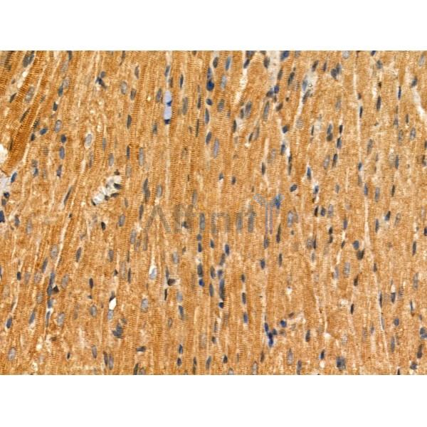 SAR1B Antibody - DF4105 at 1/100 staining Rat heart tissue by IHC-P.