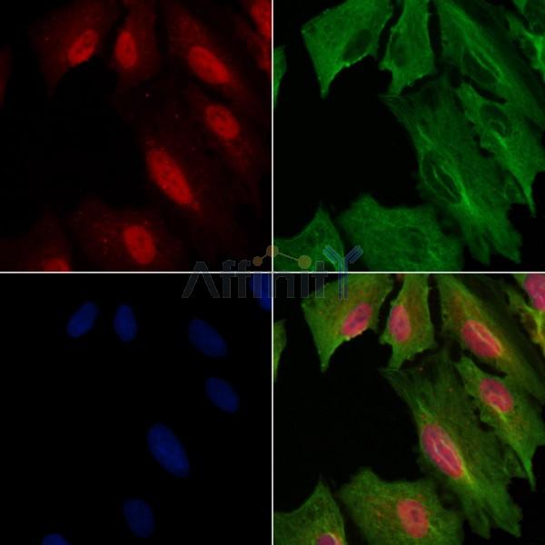 PPP4R1L Antibody - DF4487 staining A549 cells by IF/ICC.