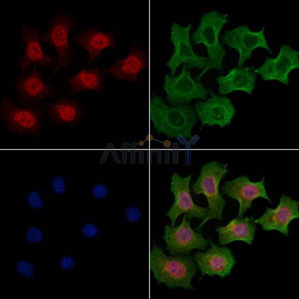 SH3TC1 Antibody - DF4502 staining Hela cells by IF/ICC.
