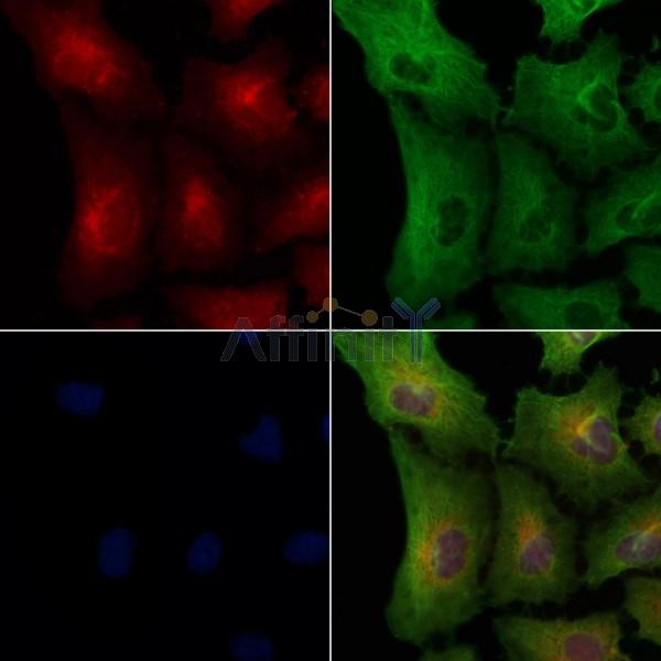 OR8G5 Antibody - DF5127 staining A549 cells by IF/ICC.