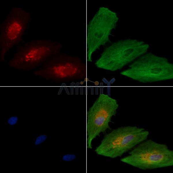 WNK3 Antibody - DF7407 staining A549 cells by IF/ICC.