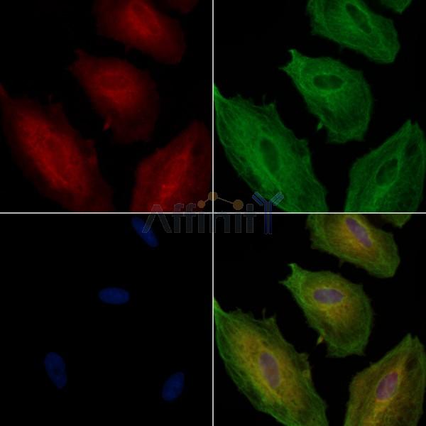 ECE1 Antibody - DF7430 staining A549 cells by IF/ICC.